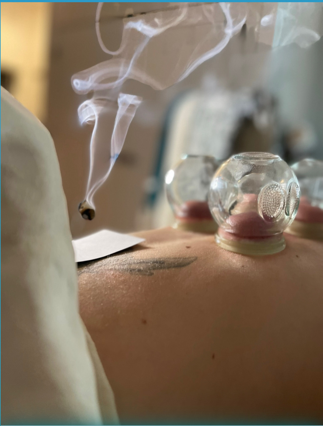 Spa specials in Austin featuring fire cupping therapy, Tui Na massage, Reiki, Gua Sha, and holistic healing at Spa La La.